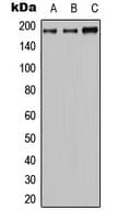 IHC-plus™ ABCC2 / MRP2 Antibody (Internal)