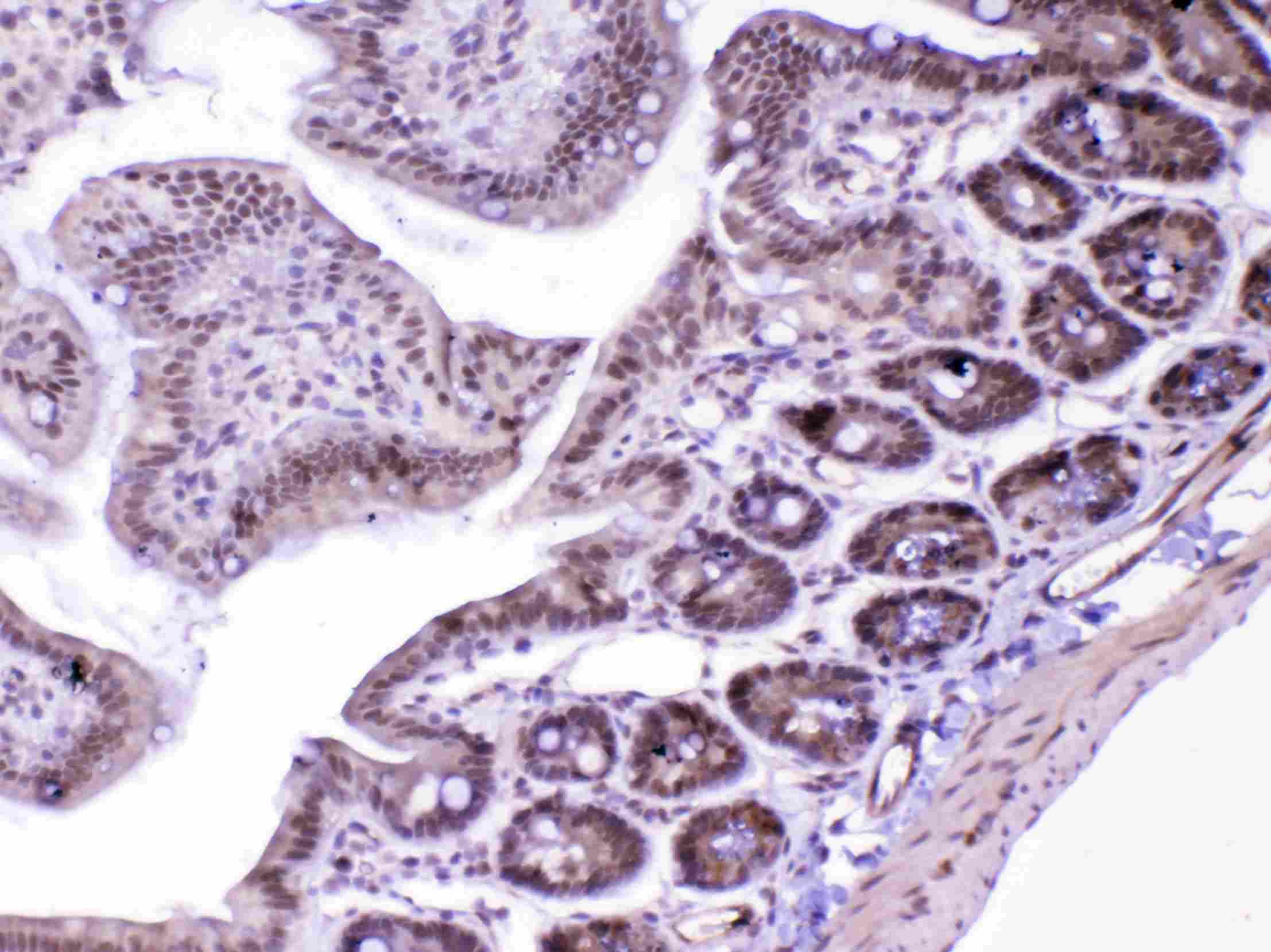 MED18 Antibody