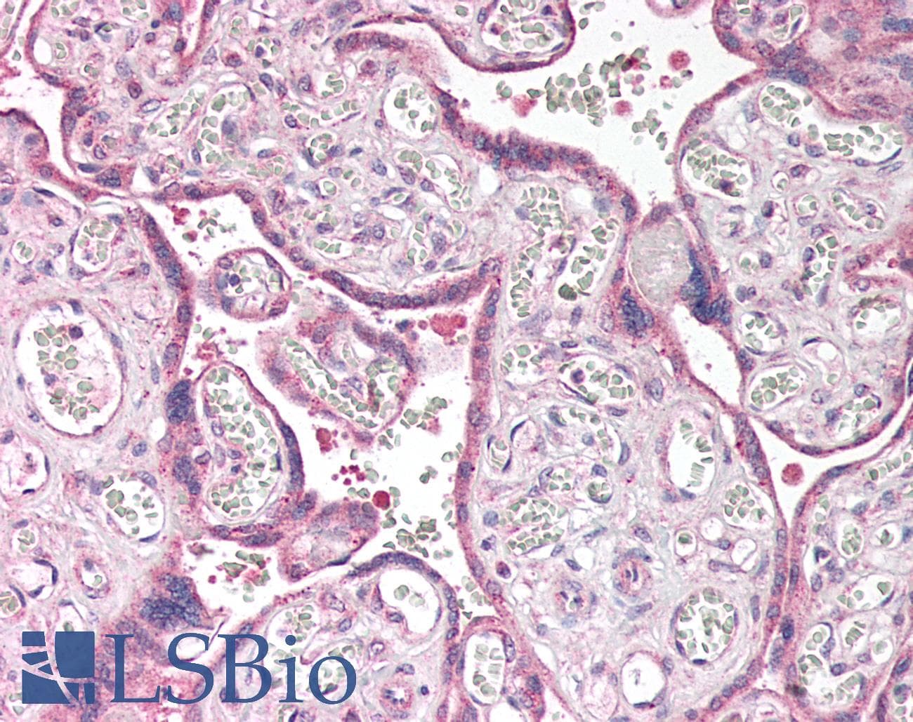 Polyclonal Rabbit anti-Human CLDN6 / Claudin 6 Antibody (IHC)