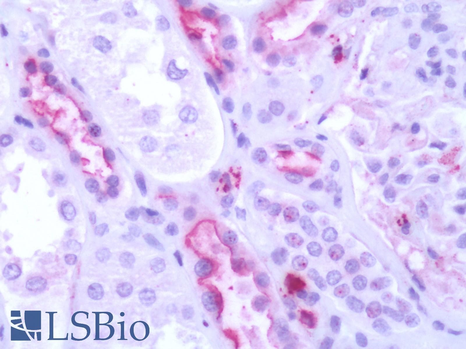 PathPlus™ GPR50 Antibody (C-Terminus)