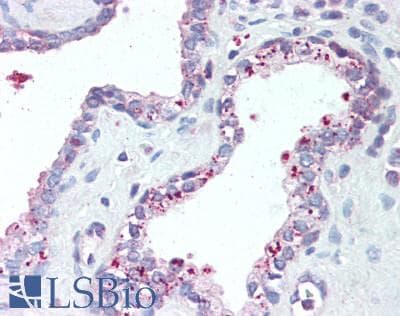 IHC-plus™ GAA / Alpha-Glucosidase, Acid Antibody