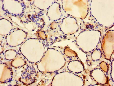 C2CD3 Antibody