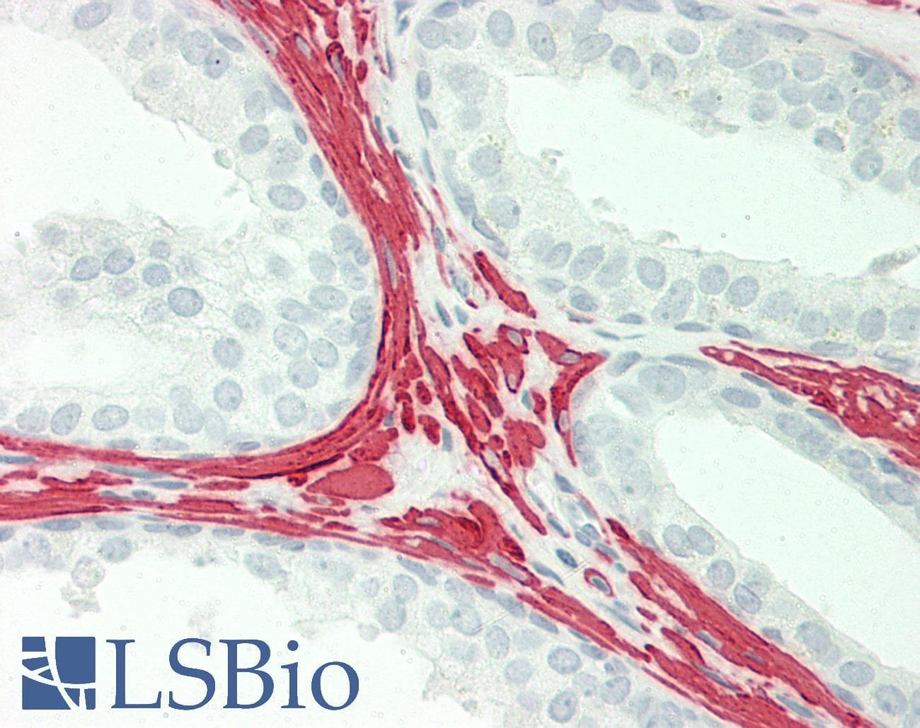 IHC-plus™ ACTA2 / Smooth Muscle Actin Antibody (clone 1H8)