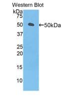 LEFTYB / LEFTY1 Antibody (aa169-368, FITC)