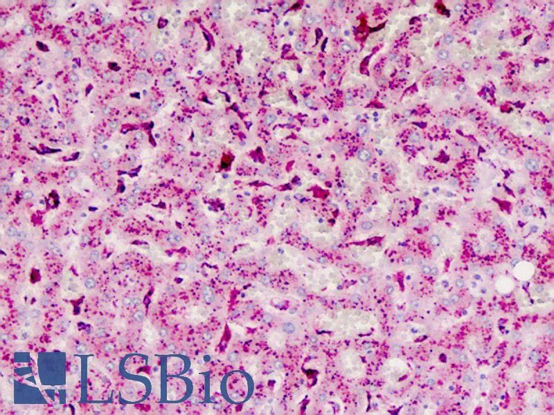 PathPlus™ CTSB / Cathepsin B Antibody (aa198-227)