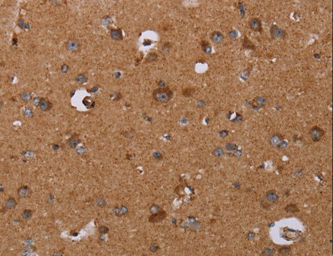 DISC1 Antibody