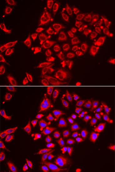 ST3GAL3 / ST3N Antibody