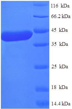 Human NTMT1 / C9orf32 Protein (Recombinant His-SUMO)