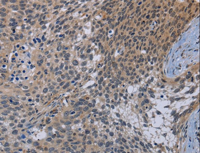 APC6 / CDC16 Antibody