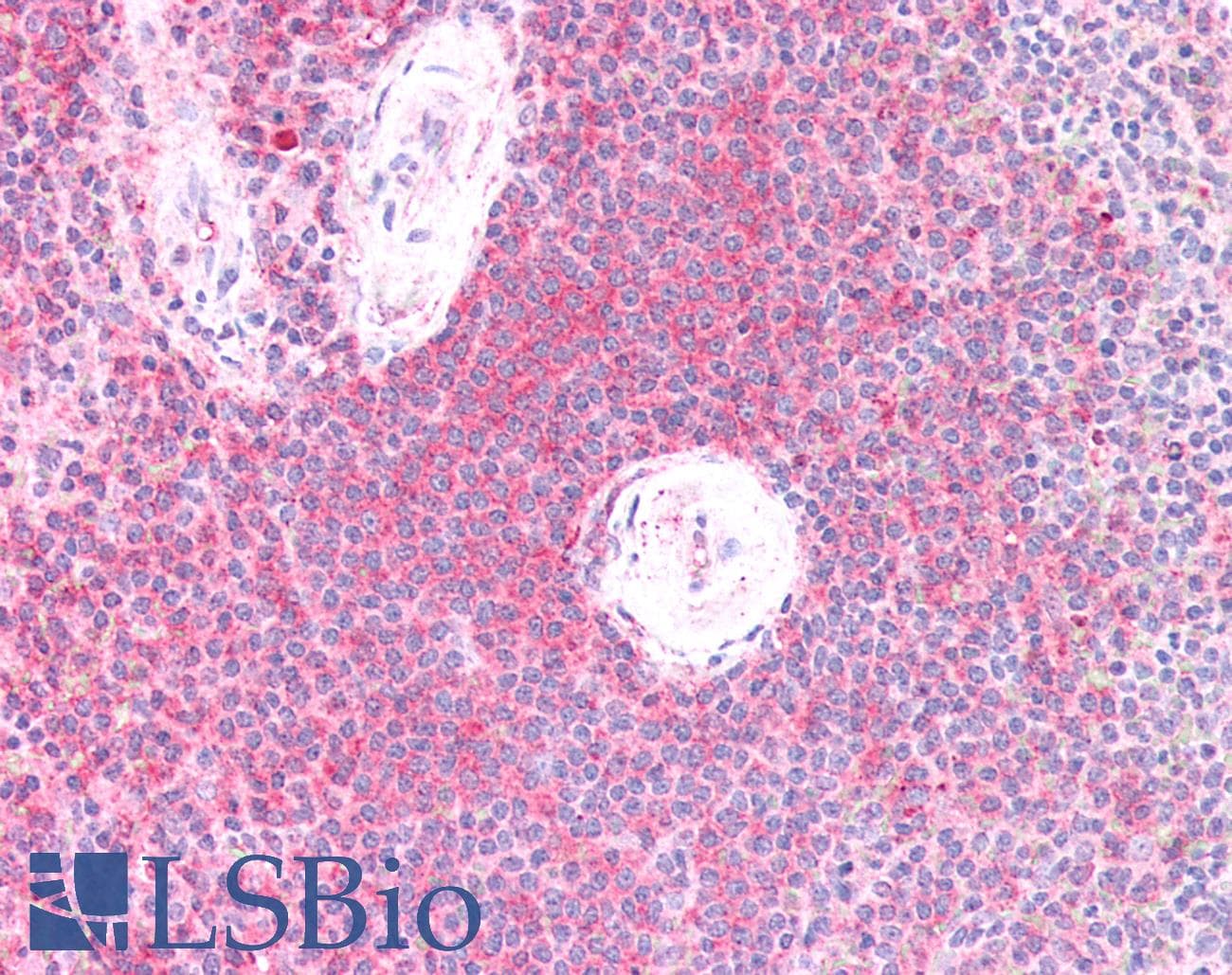 IHC-plus™ Polyclonal Rabbit anti-Human LIMS1 / PINCH Antibody (IHC, IF, WB)