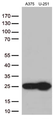 TAGLN2 / Transgelin 2 Antibody (clone OTI7A5)