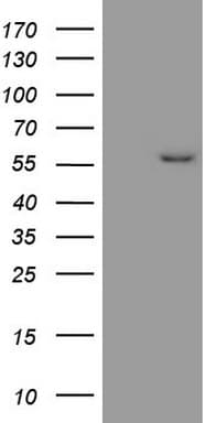 MMP3 Antibody (aa246-477, clone OTI2H6)