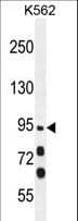 MYO19 / Myosin XIX Antibody (aa554-582)