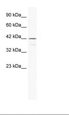 Polyclonal Rabbit anti-Human SOX3 Antibody (aa80-129, IHC, WB)