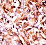 Polyclonal Rabbit anti-Human BAD Antibody (phospho-Ser99, IHC, IF, WB)