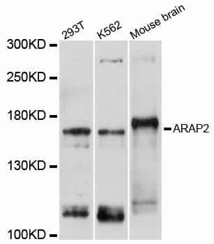Polyclonal Rabbit anti-Human ARAP2 / CENTD1 Antibody (WB)