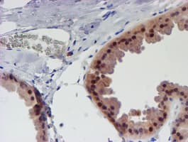 UNG / Uracil DNA Glycosylase Antibody (clone OTI1F8)