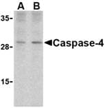 IHC-plus™ CASP4 / Caspase 4 Antibody