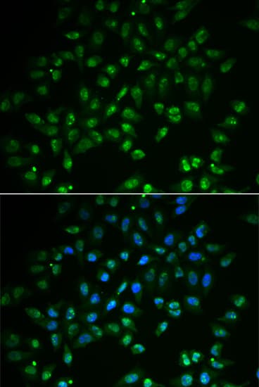 IHC-plus™ Polyclonal Rabbit anti-Human DHAND / HAND2 Antibody (IHC, IF, WB)