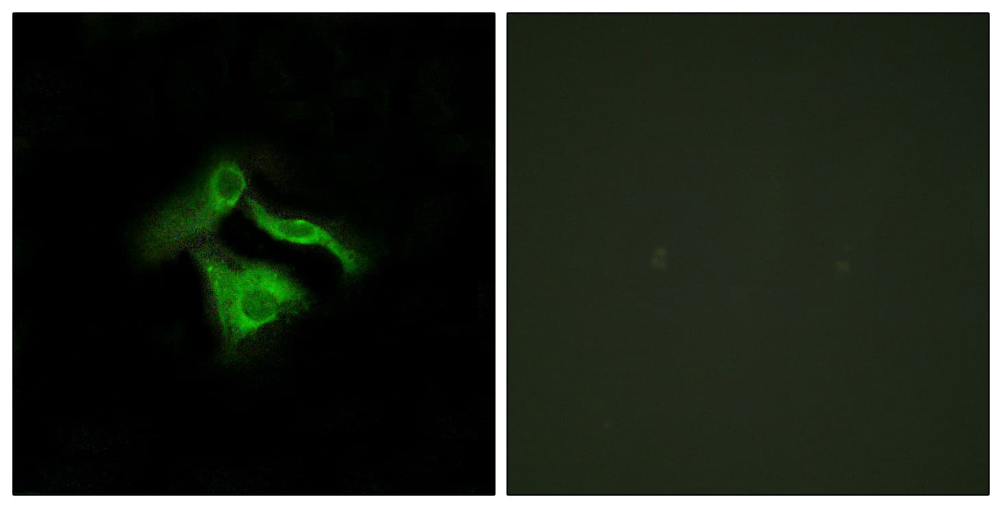 GPR149 / PGR10 Antibody (aa451-500)