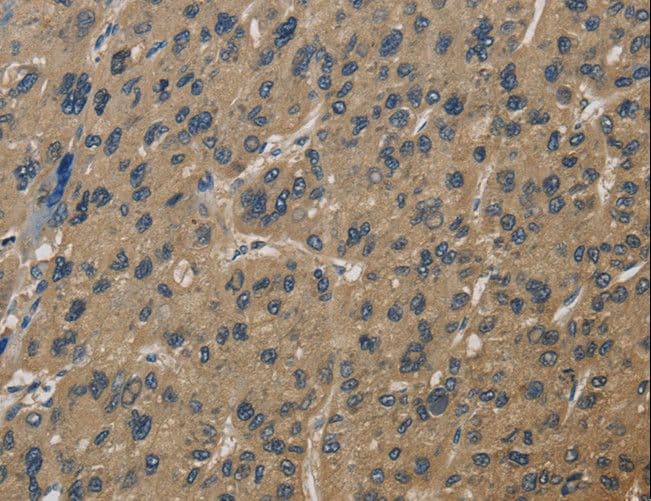 Polyclonal Rabbit anti-Human CORO1C Antibody (IHC, WB)