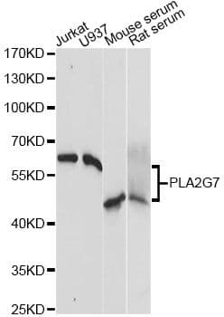 Polyclonal Rabbit anti-Human LP-PLA2 / PLA2G7 Antibody (WB)
