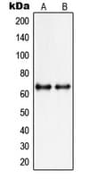Polyclonal Rabbit anti-Human PIAS3 Antibody (N-Terminus, IHC, WB)