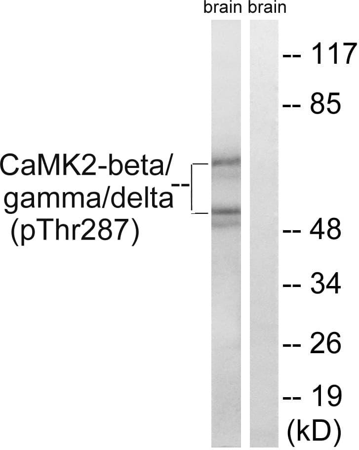 CaMKII Beta+Gamma+Delta Antibody (phospho-Thr287)
