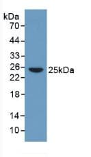 CRP / C-Reactive Protein Antibody (aa17-224, APC)