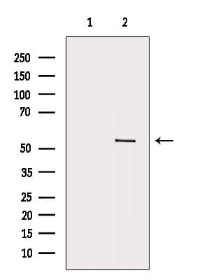 DDX6 Antibody