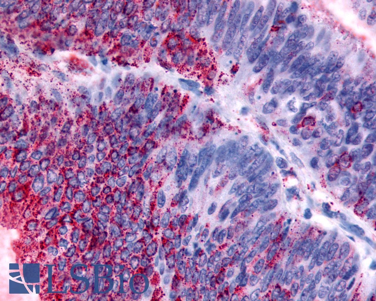 PathPlus™ HRH4 / Histamine H4 Receptor Antibody (Cytoplasmic Domain)