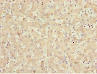 Polyclonal Rabbit anti-Human KLF15 Antibody (IHC)