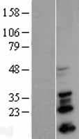 Human SNAI1 / SNAIL-1 Protein (Over-Expression Lysate Myc-DDK (Flag))