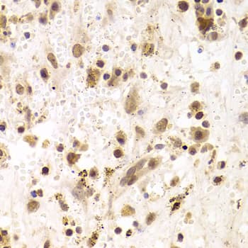 PRPF3 Antibody
