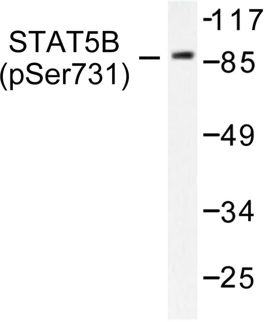 STAT5A Antibody (phospho-Ser726)