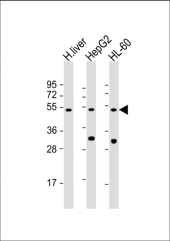 Polyclonal Rabbit anti-Human BAAT / BAT Antibody (N-Terminus, WB)