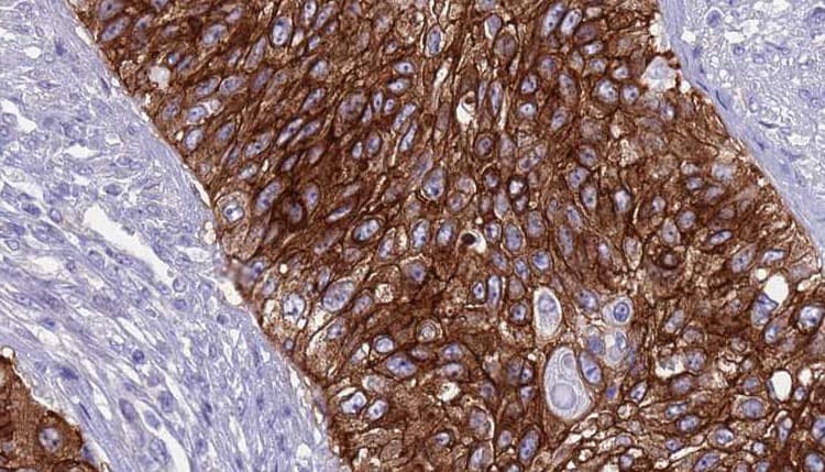 Polyclonal Rabbit anti-Human TGFBR2 Antibody (IHC, WB)