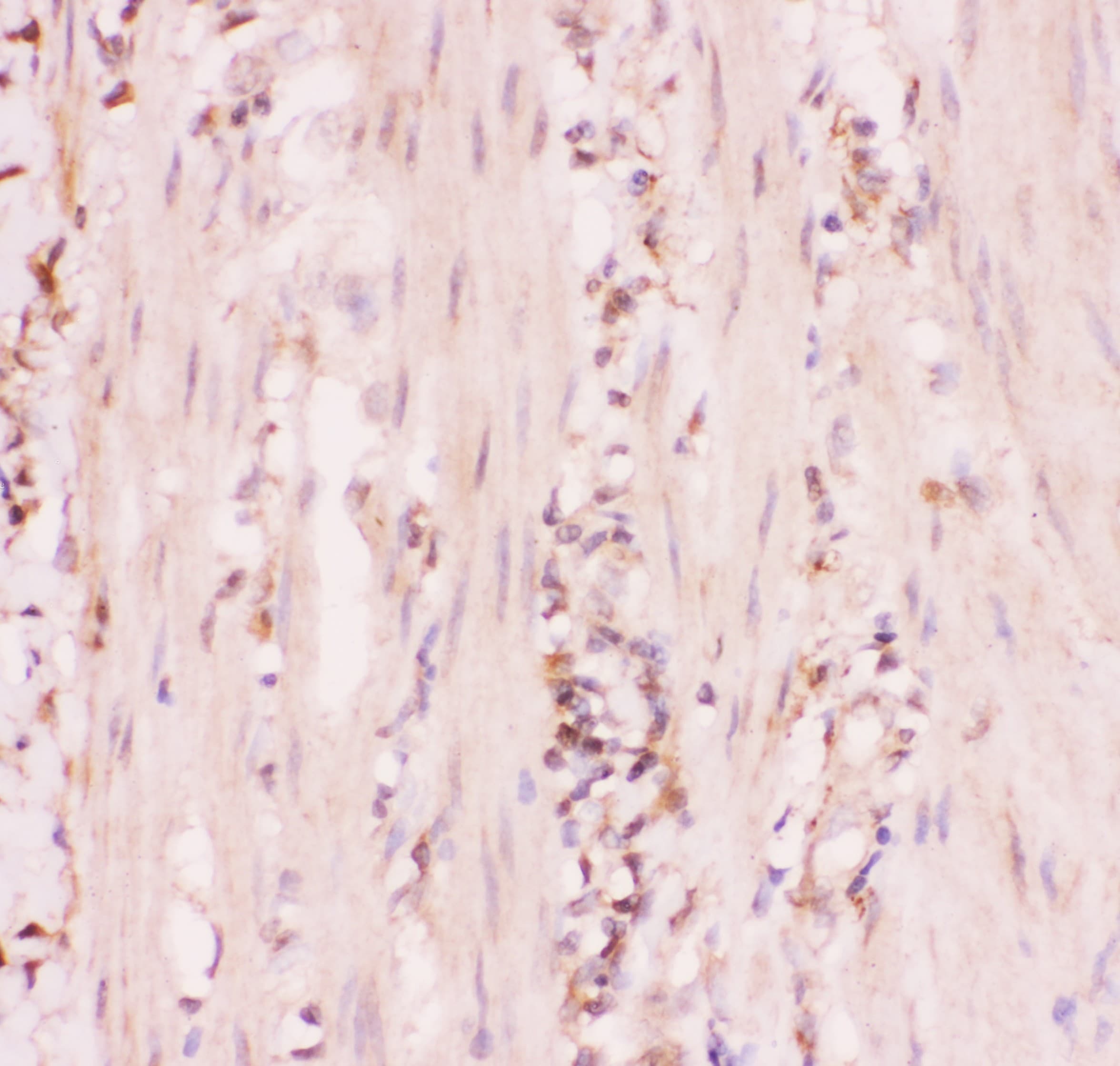 ABCC4 / MRP4 Antibody (aa1-370)