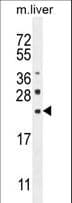 CLEC2L Antibody (aa26-54)