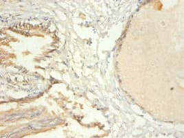Polyclonal Rabbit anti-Human TRIM28 / KAP1 Antibody (IHC, WB)