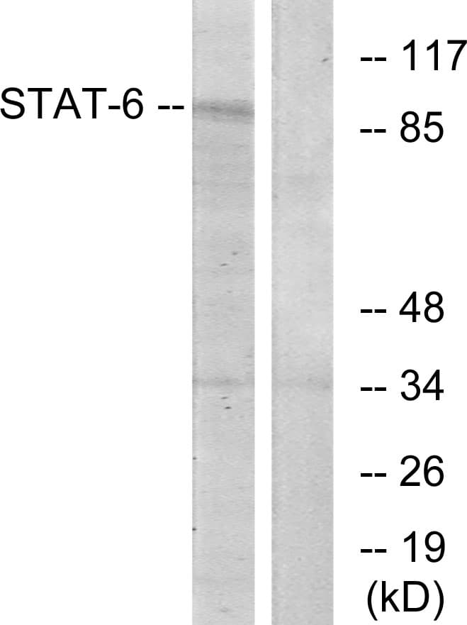 Polyclonal Rabbit anti-Human STAT6 Antibody (aa608-657, IHC, WB)