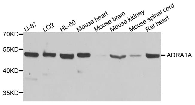 Polyclonal Rabbit anti-Human ADRA1A Antibody (WB)