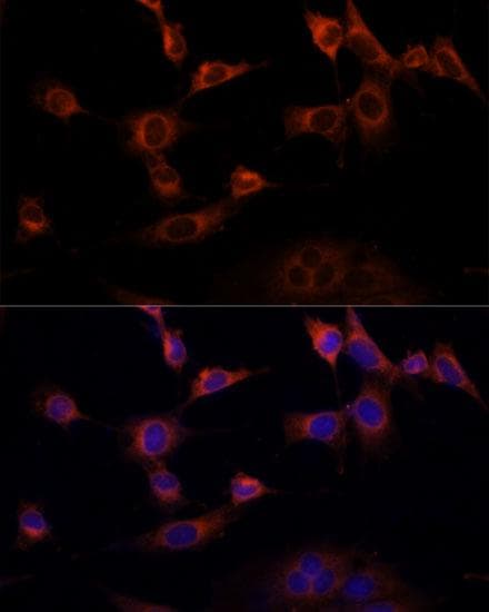 Polyclonal Rabbit anti-Human WWOX Antibody (IF)