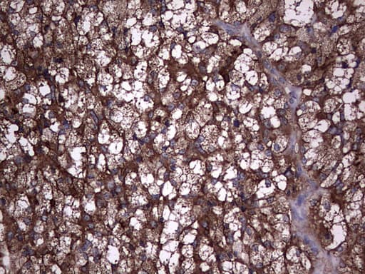 TG / Thyroglobulin Antibody (aa20-358, clone OTI8E4)