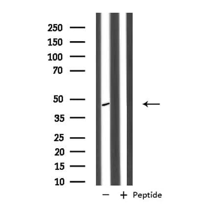 Polyclonal Rabbit anti-Human PPP1R7 Antibody (IF, WB)
