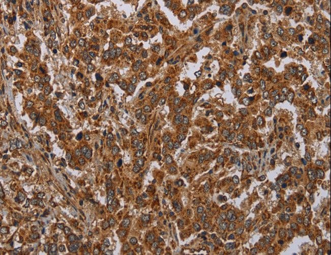 ATP2A1 / SERCA1 Antibody