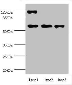 Polyclonal Rabbit anti-Human CCT5 / TCP1 Epsilon Antibody (IHC, WB)