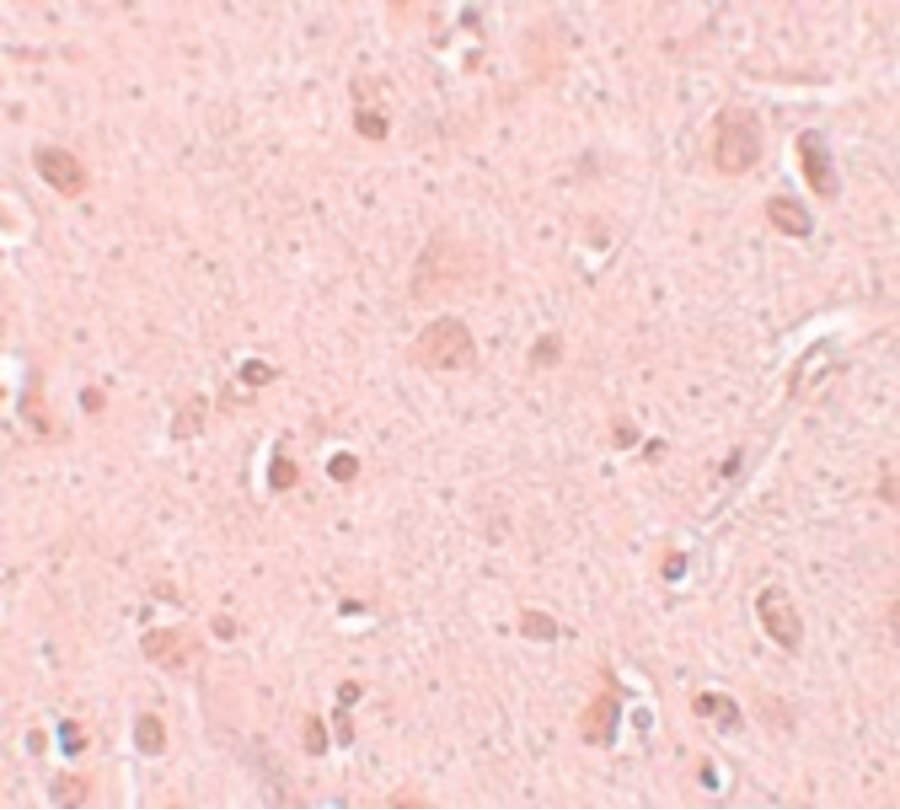 Hypothetical Protein / TINP1 Antibody