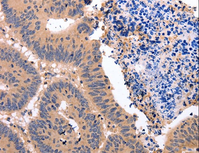 Glucocorticoid Receptor Beta Antibody