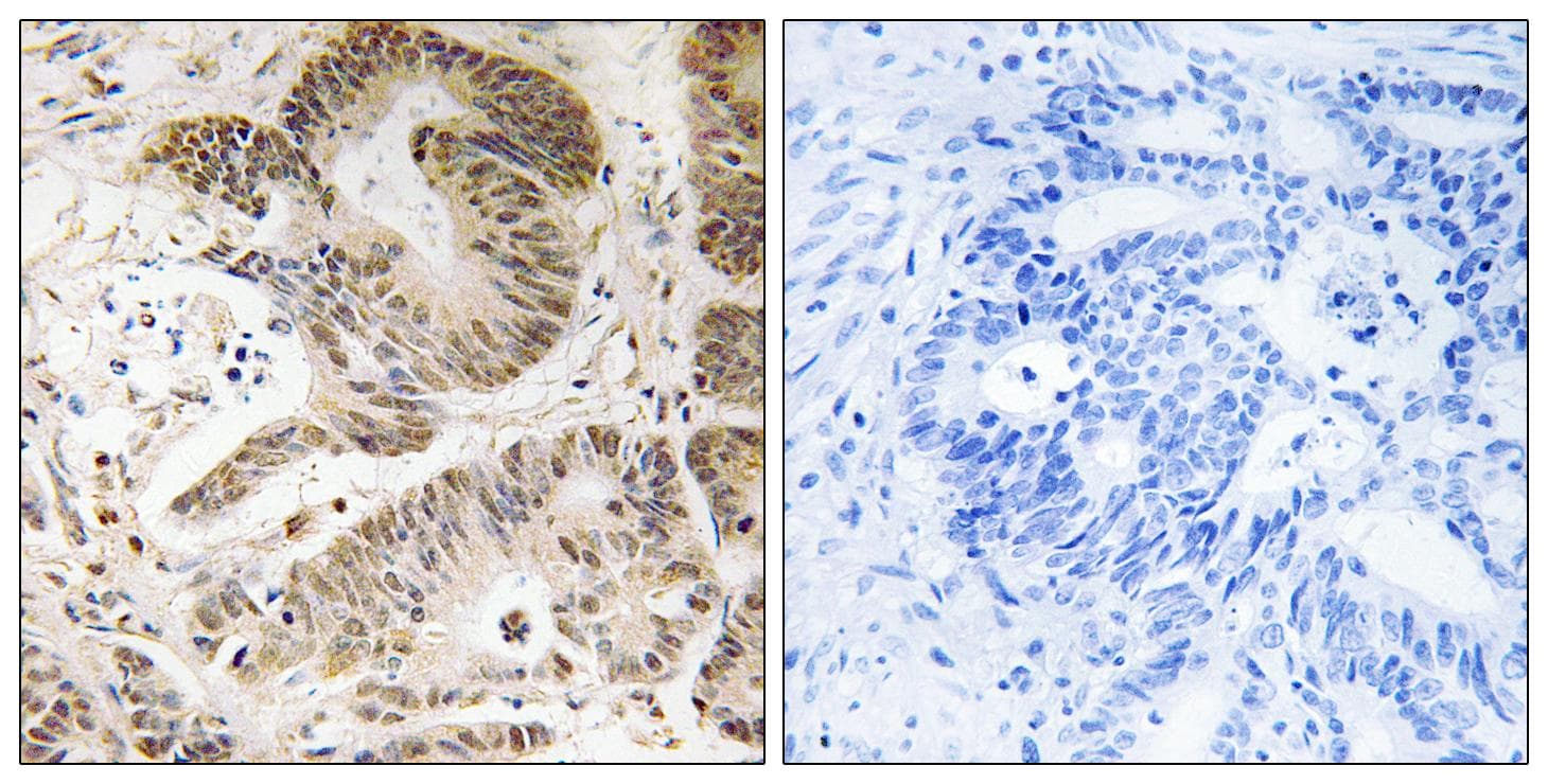 Polyclonal Rabbit anti-Human PIK3R5 Antibody (IHC)